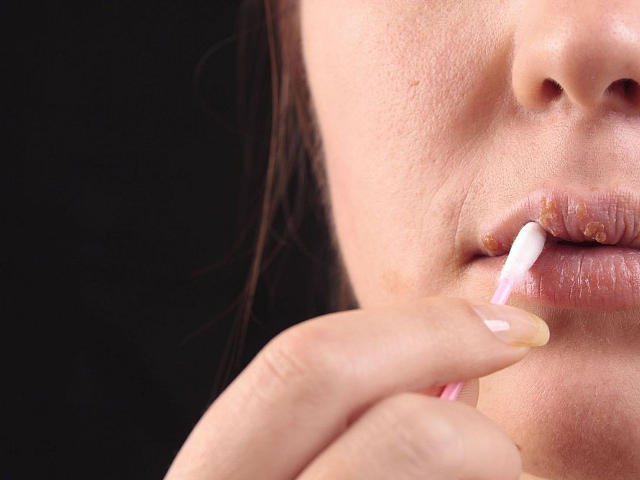 Les boutons enflammés selon toute la personne